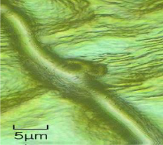 Hifa vitala de fainare
